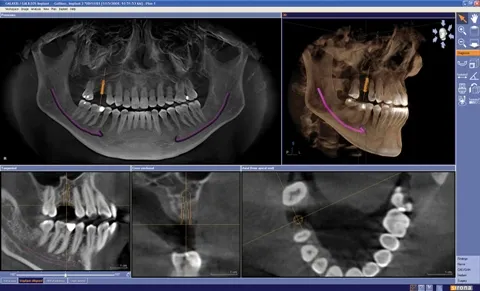 Cone Beam CT images showing multiple views